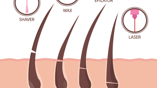 Liberate Your Skin: Unveiling the Magic of Laser Hair Removal