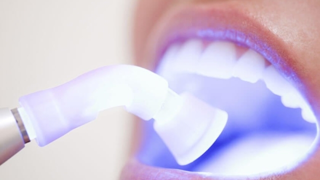 12 Tips for a Dazzling White Smile: Unveiling the Secrets of Teeth Whitening