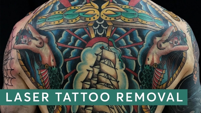 Gang Tattoo Removal – Your Practical Solution A Good Unwanted Tattoo