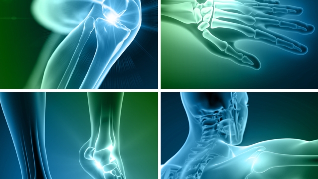 Bones, Joints, and Beyond: A Dive into Orthopedics